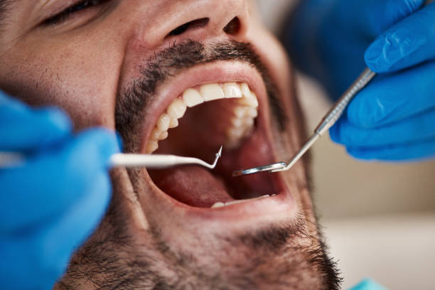 Best After-Hours Dental Trauma Care in Lake City, IA