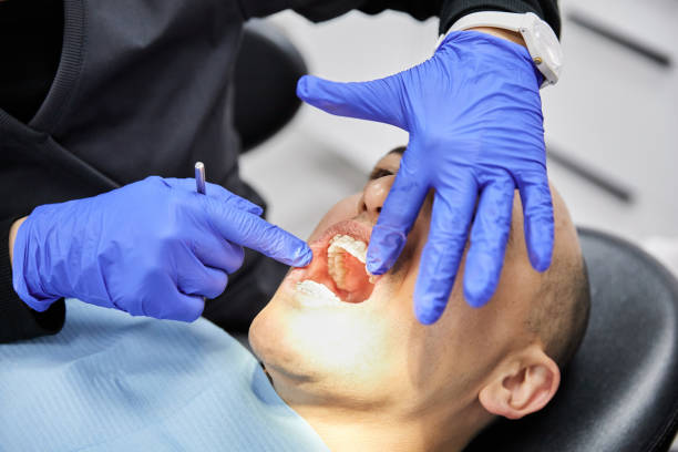 Best Emergency Tooth Extraction in Lake City, IA