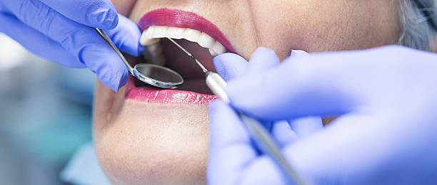 Best Emergency Denture Repair in Lake City, IA
